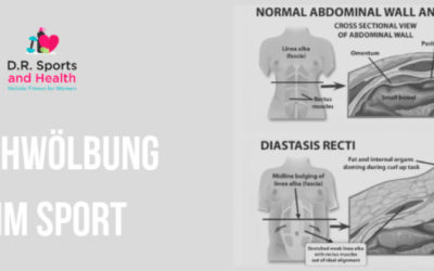 Woher kommt eigentlich eine Bauchwölbung?
