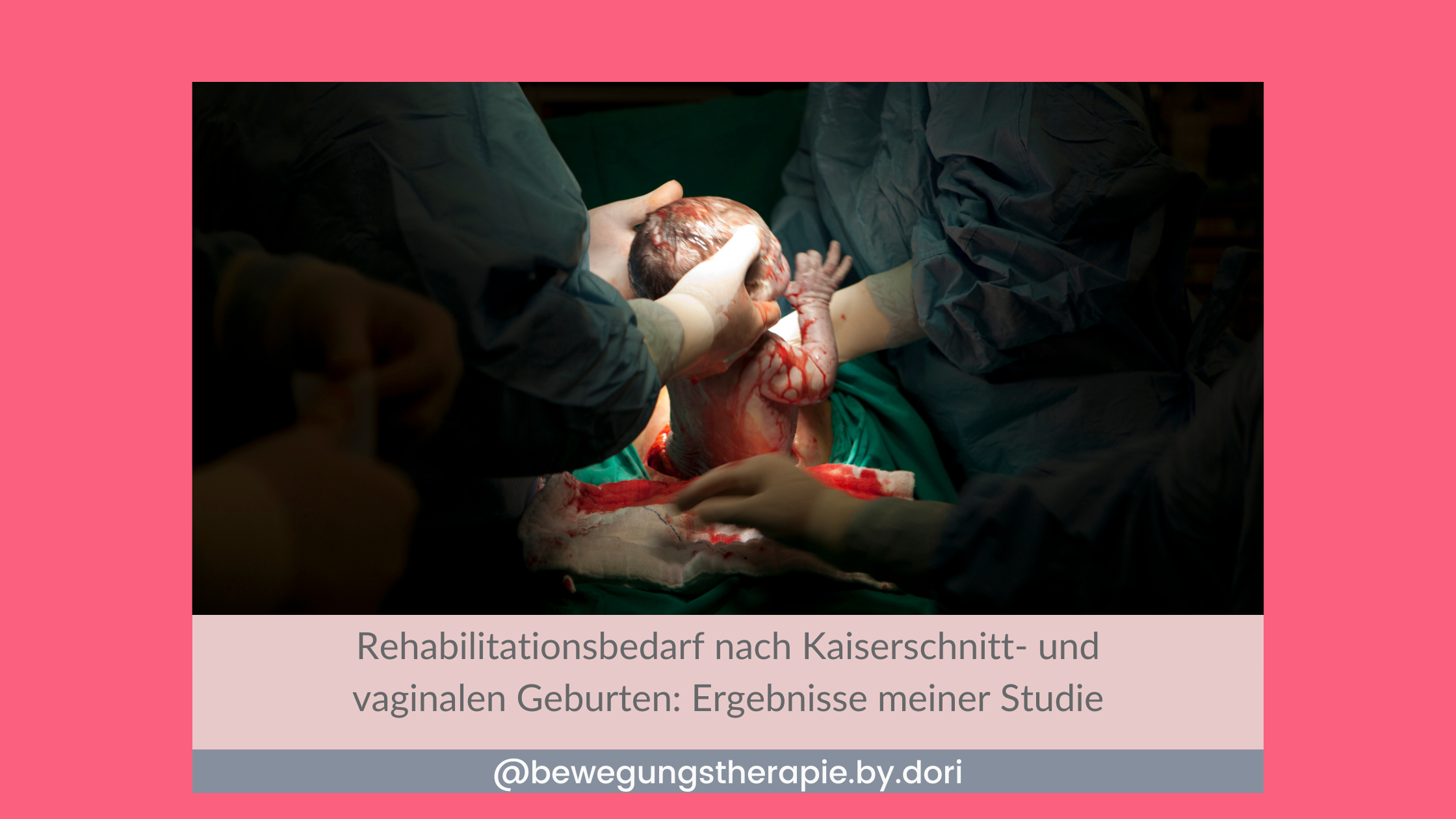 Baby das aus dem Bauch geholt wird