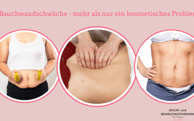 Bauchwandschwäche – Mehr als ein kosmetisches Problem
